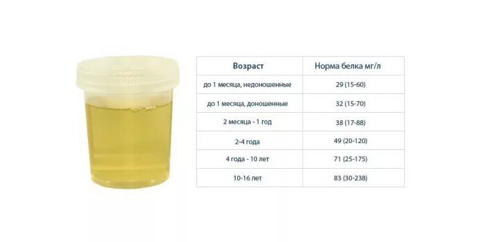 Белок в моче у ребенка 1 год норма. Норма белка в моче у детей до 1 года. Норма белка в моче у детей 2 года. Норма белка в моче у ребенка 1 год.