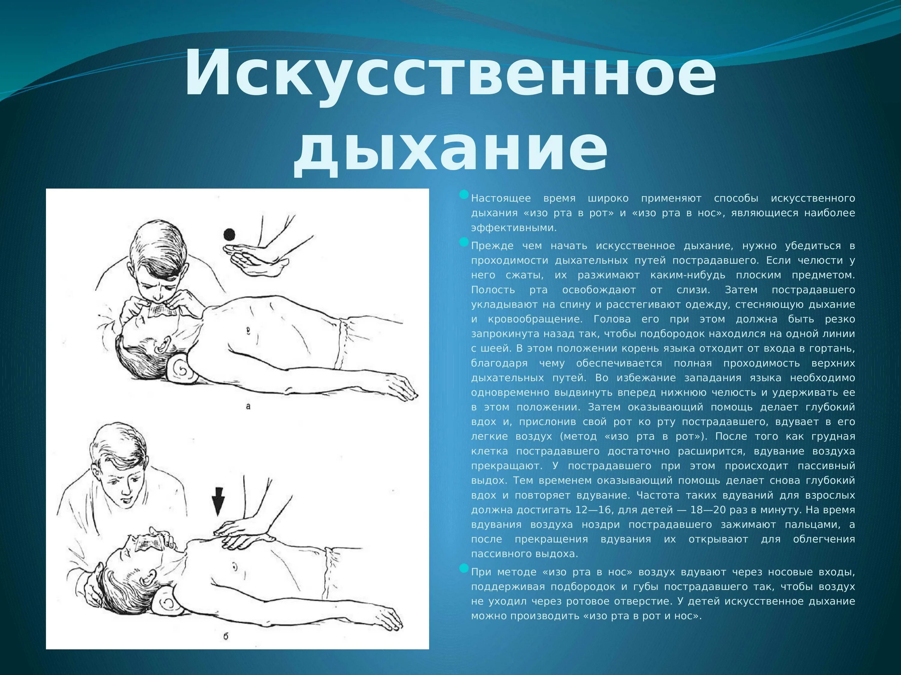 Способы проведения искусственного дыхания. Искусственное дыхание методика выполнения. Схему выполнения искусственного дыхания..