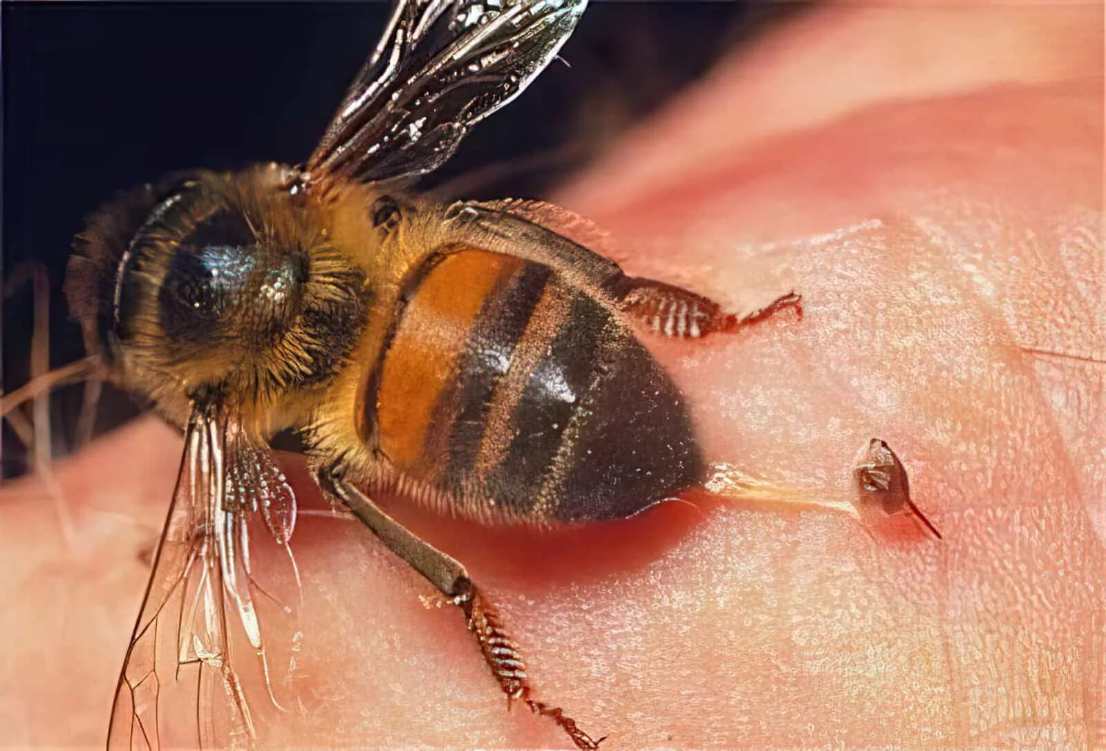 Шмель пчела Оса Шершень. Шмель пчела Оса Шершень укусы. Оса пчела Шмель Шершень отличия. Жало пчелы осы шмеля и шершня.