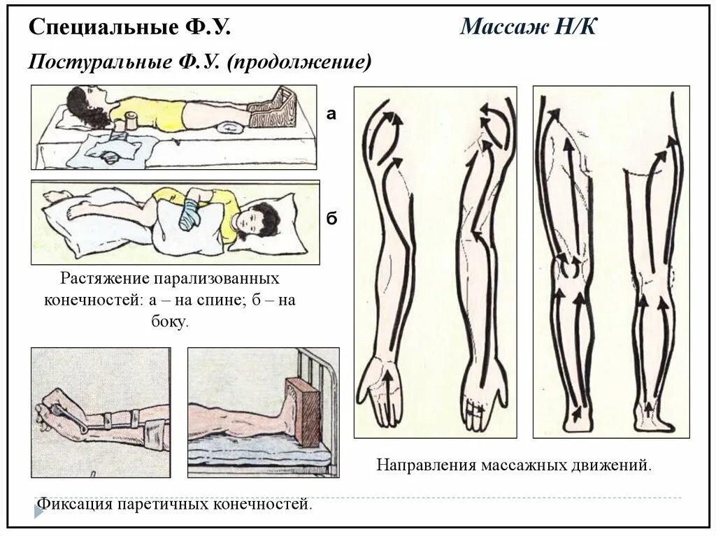 Постуральный массаж. Направление на массаж. Паретичных конечностей. Направление массажных движений.