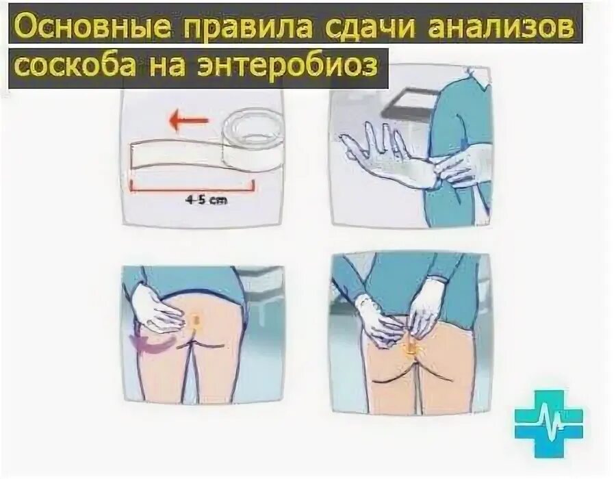Энтеробиоз как берут у взрослых. Исследование соскоба на энтеробиоз. исследование соскоба на энтеробиоз анализ. анализ на энтеробиоз как сдавать. исследования на энтеробиоз как берут.