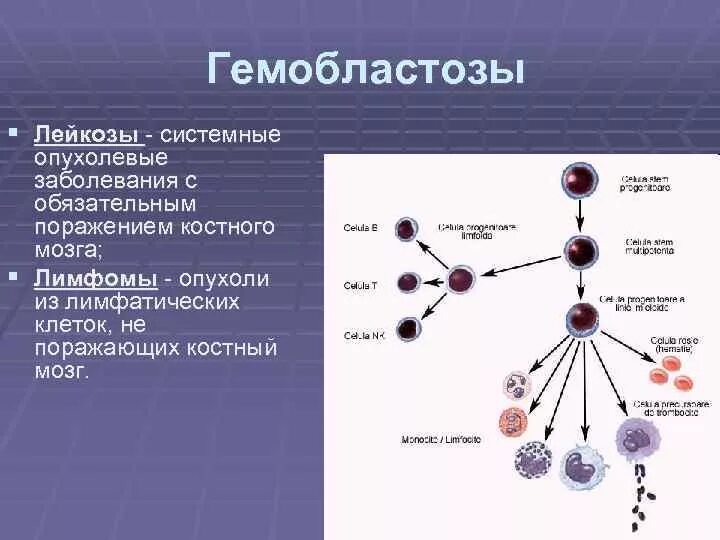 Гемобластозы — заболевания кроветворной ткани:. Гемобластозы лейкозы. Гемобластозы классификация. Гемобластозы классификация принцип.