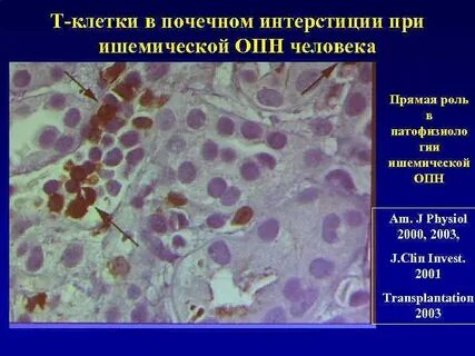 Какие клетки в почках
