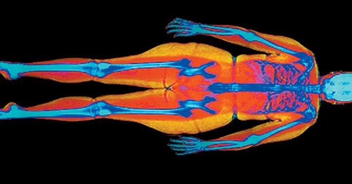 Саркопеническое ожирение. Ожирение по женскому типу у мужчин. Саркопеническое ожирение. Ожирение мышц. Нормальное тело.