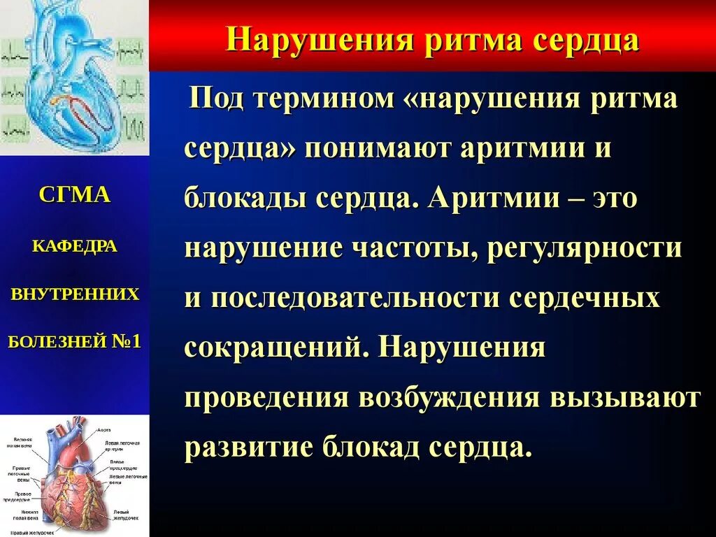 Нарушение ритма сердца помощь. Нарушение ритма. заболевания сердца ритма. заболевания с нарушением ритма сердца. клинические проявления нарушения ритма сердца.