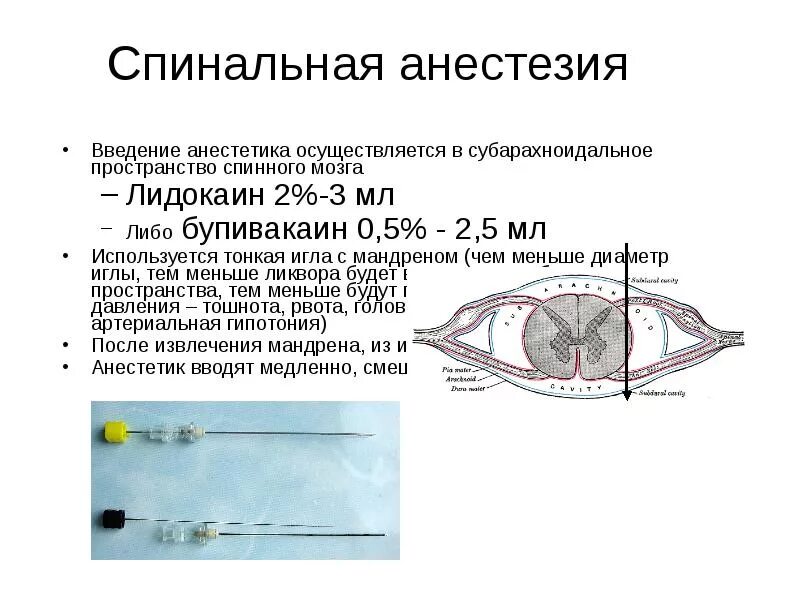 После спинального наркоза