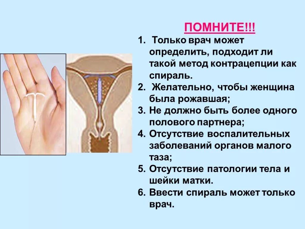 Внутриматочная гормональная спираль мирена. Как понять что спираль. Виды контрацептивов. Золотое сечение спираль фибоначчи формула. Осложнения при введении вмс.