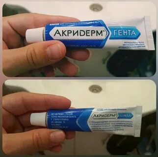 Акридерм от прыщей на лице помогает ли