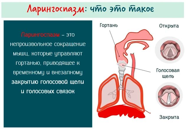 Сокращение мускулатуры гортани. Стеноз гортани и ларингоспазм. Рефлекторный ларингоспазм. Сокращение глотки