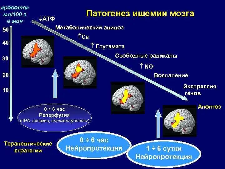 Патогенез ишемии мозга. Нейропротективная терапия. Церебральная ишемия патогенез. Патогенез хронической ишемии головного мозга. Механизмы развития ишемии