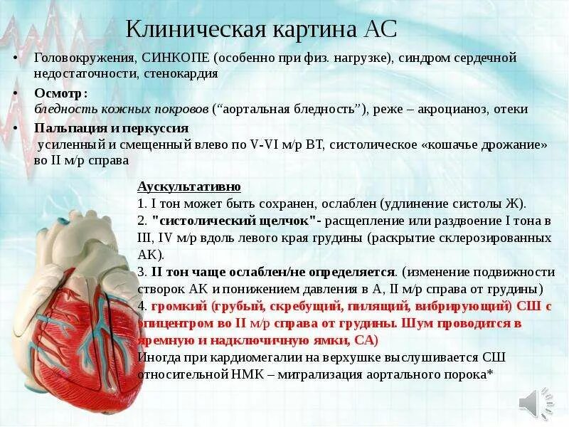 Ишемия стенокардия инфаркт. Стенокардия презентация. Гемодинамически значимый стеноз коронарных артерий. Сердце при стенокардии. Ибс стенокардия инфаркт миокарда.