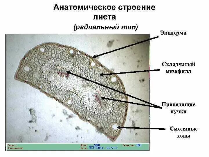Радиальный лист. Радиальный лист