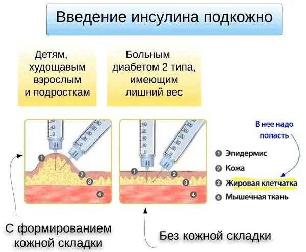 Инсулинотерапия при сахарном диабете 1. Способы введения препаратов инсулина. Алгоритм введения подкожной инъекции инсулина. Введение инсулина при диабете. Введение инсулина шприц ручкой алгоритм.