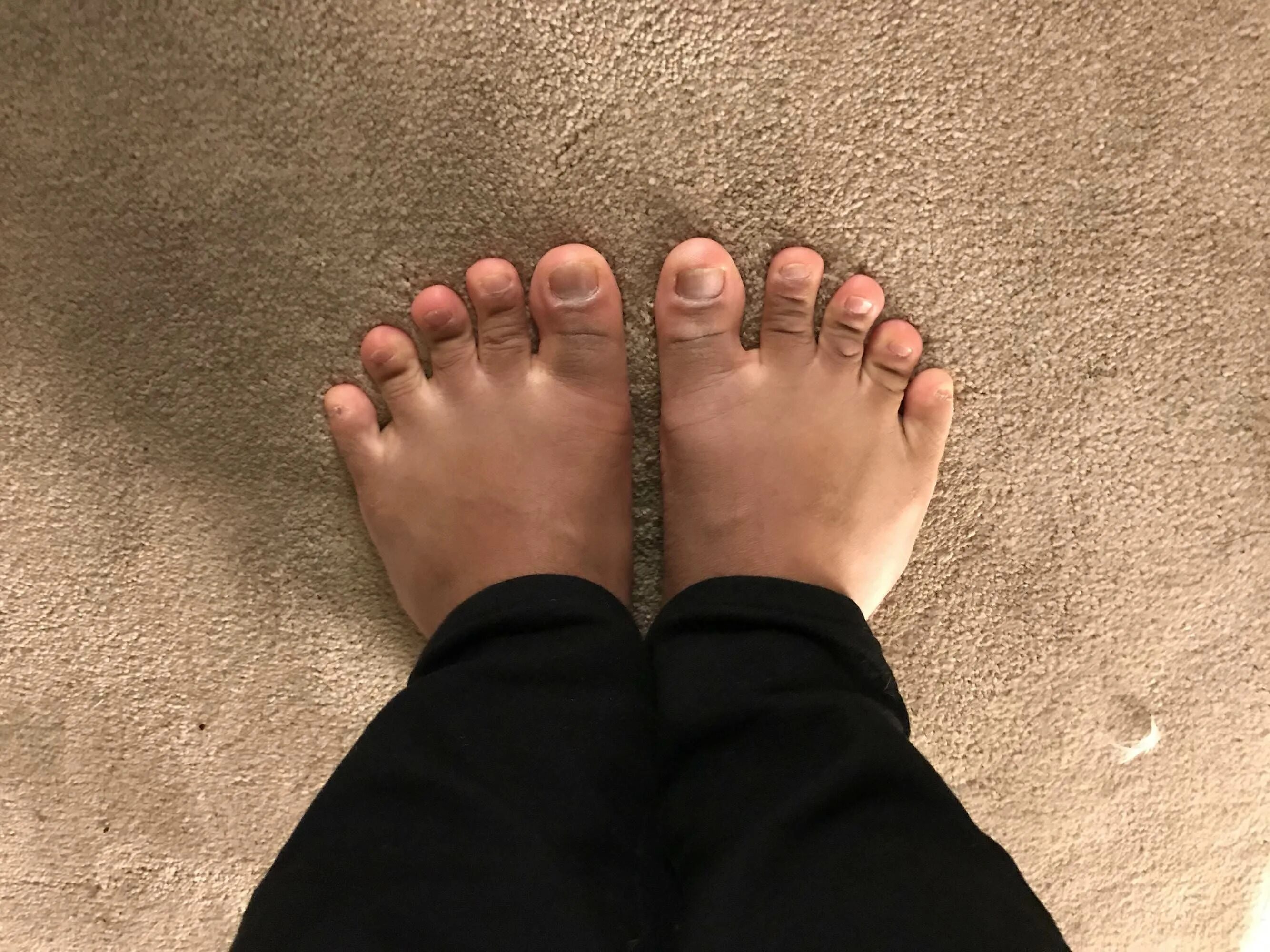 Wide feet