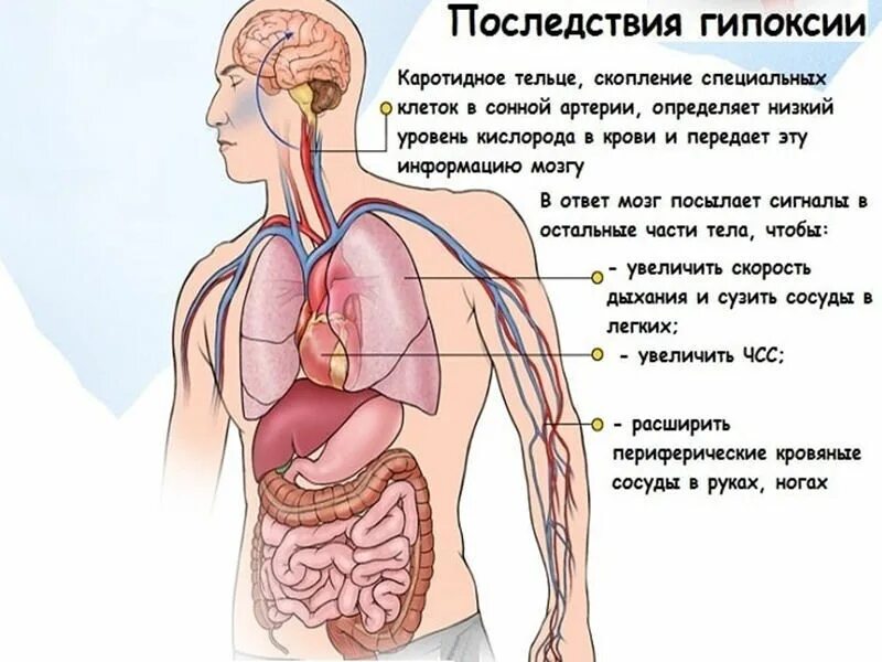 Кислородное голодание мозга у взрослых. Гипоксия. Безкислороднте голодание. Признаки гипоксии. Гипоксия кислородное голодание.