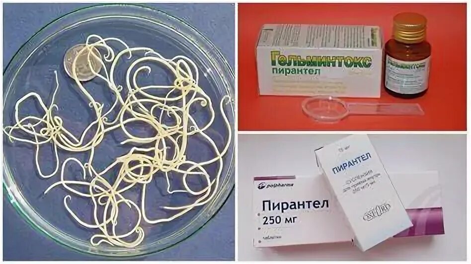 Гельминты у детей. Гельминты у детей