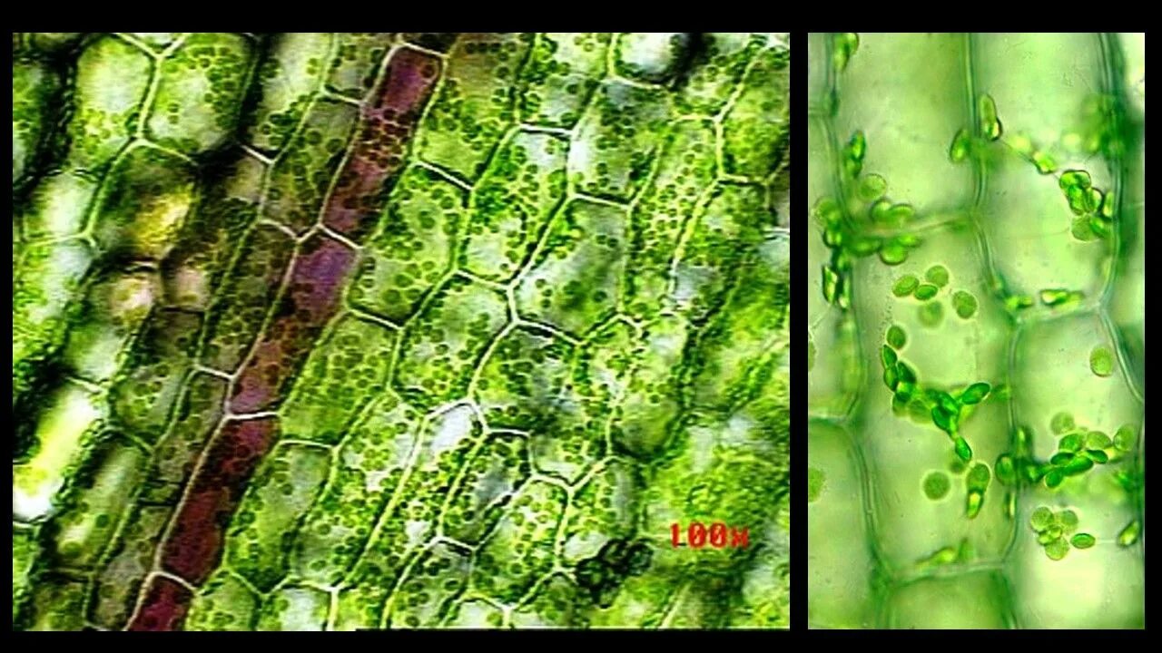 Хлоропласты в клетках листьев крупные. Хлорофилл листа элодеи. Кутикула у элодеи. Клетки листа элодеи под микроскопом. Клетки растения Элодея под микроскопом.