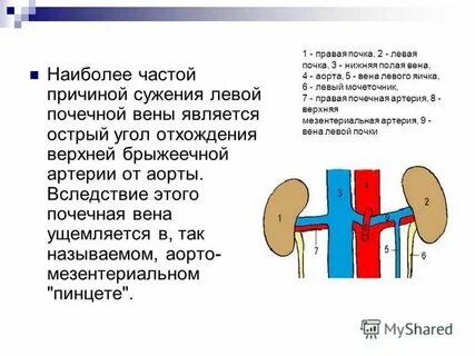 Левосторонняя почечная