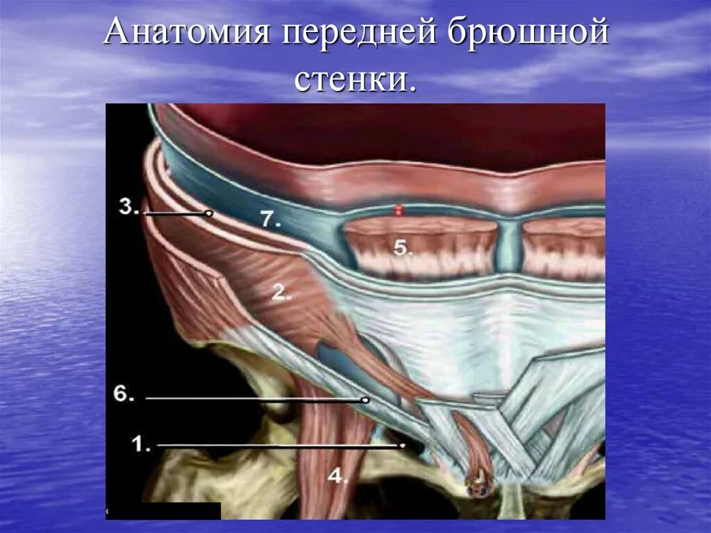 Лапароскопическая анатомия передней брюшной стенки. Таох передней брюшной стенки. Передняя брюшная стенка анатомия. Передняя брюшная стенка топографическая анатомия. Толстая брюшная стенка