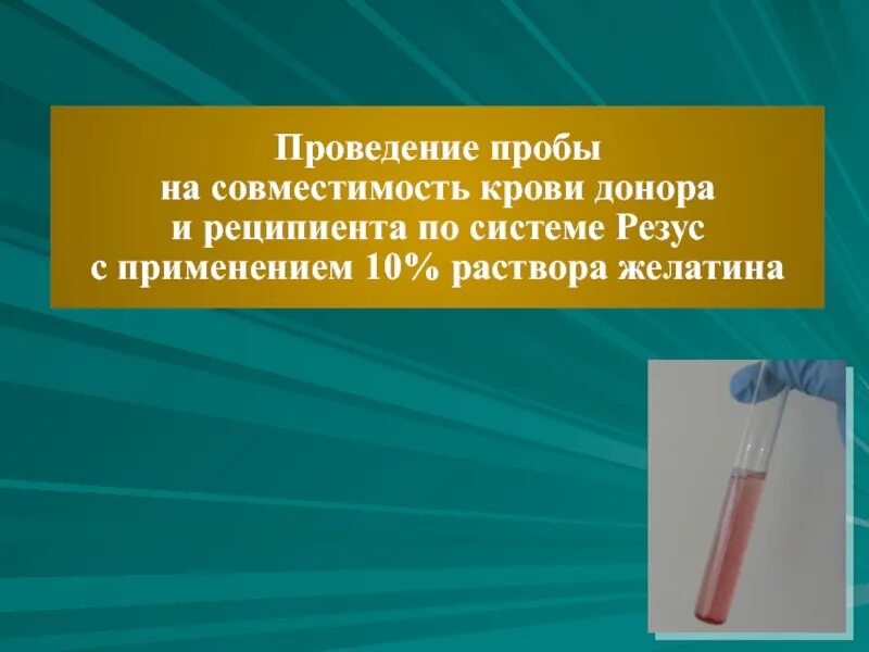 Проведение проб на совместимость крови донора и реципиента. Проведение проб на совместимость. Проба на совместимость донора и реципиента. Пробы на индивидуальную совместимость донора и реципиента.