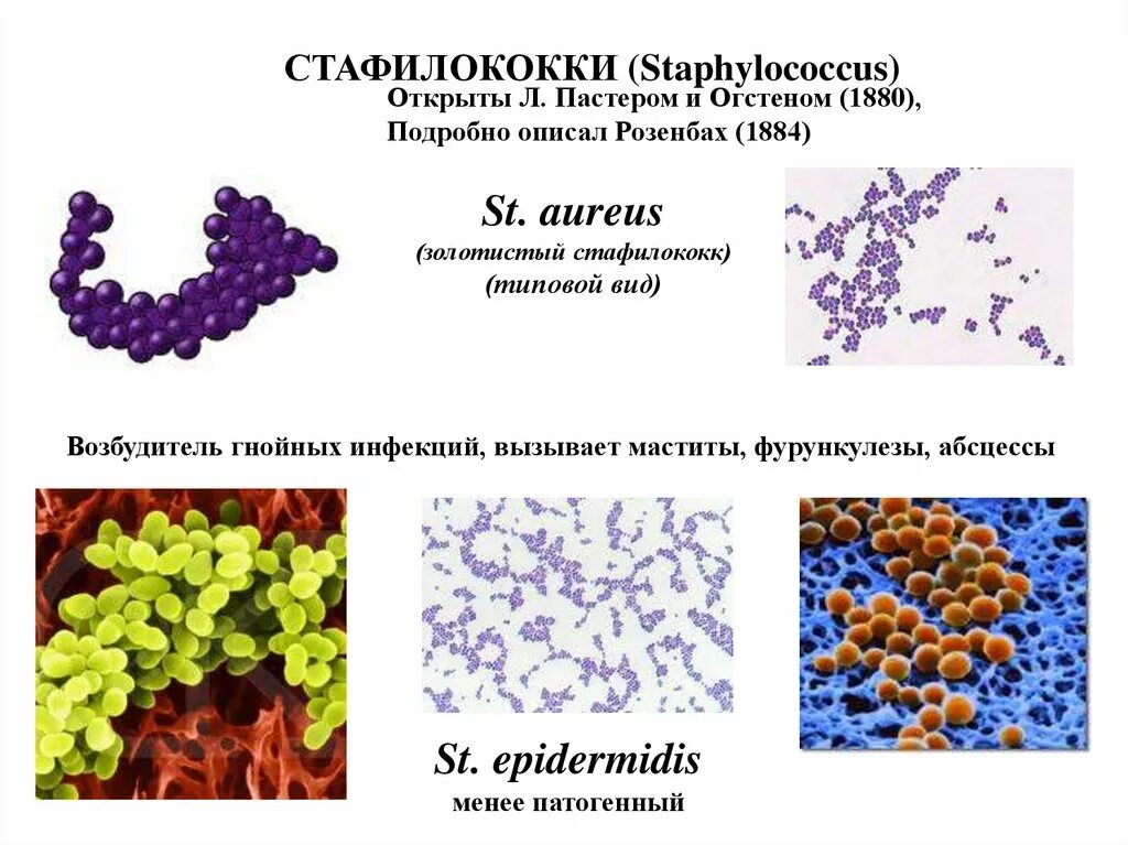 Стафилококк aureus. Непатогенные стафилококки. Стафилококки микробиология. 1 staphylococcus aureus