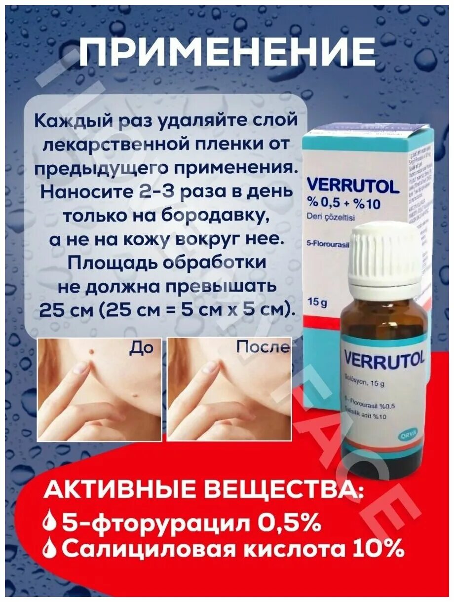 Verrutol от папиллом. Verrutol от бородавок турция отзывы. Верутол отзывы. Verrutol инструкция. Веррутол.
