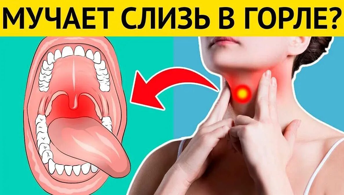 Почему мокрота в горле. Горло скапипаеться слизи. слизь в горле и носоглотке.
