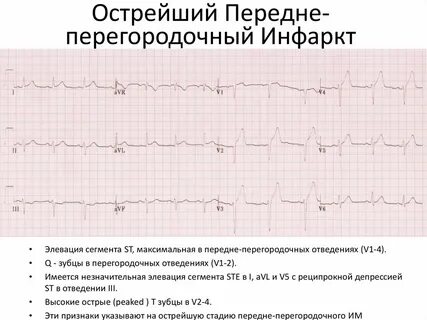 Им с острой