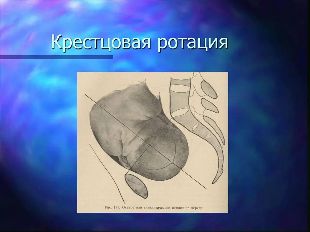 Крестцовая ротация. Хирургическая головка плеча. Перелом проксимального метаэпифиза плечевой кости. Ротация головки. Что такое крестцовая ротация в биомеханизме родов.