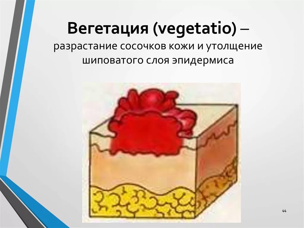 Вегетация определяется. Вегетация Дерматовенерология. Первичные морфологические элементы кожи бугорок.