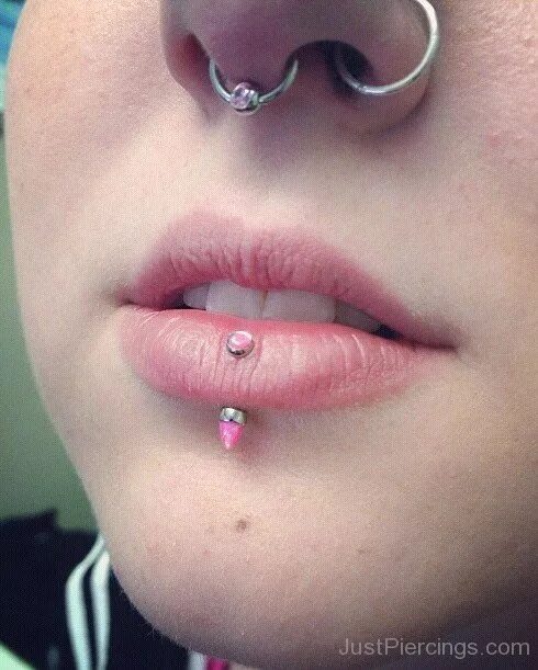 Прокол губы вертикальный лабрет. Губа после прокола. Шрамы после пирсинга верхней губы. Пирсинг над верхней губой. Лабрет пирсинг губы монро.