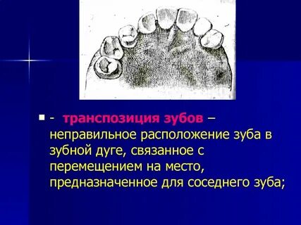 Неправильная форма зуба