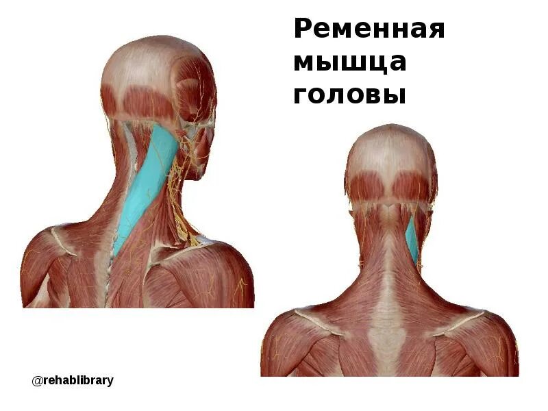 Ременная мышца головы. Мышцы затылка. Затылочные мышцы. Мышцы в затылочной цастиголовы.