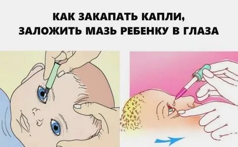 Коньюктивитный мешок куда капать капли