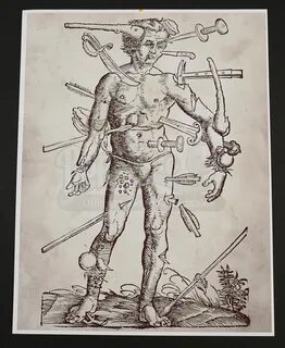 Wound man