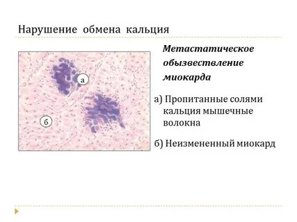 Макрофаги селезенки