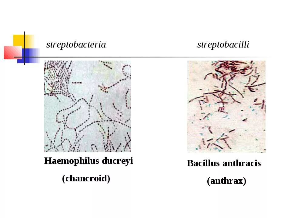 Haemophilus в мазке у мужчин. Haemophilus ducreyi антибиотики. Факторы патогенности Haemophilus ducreyi. Бактерия Haemophilus ducreyi (палочка Дюкрея).