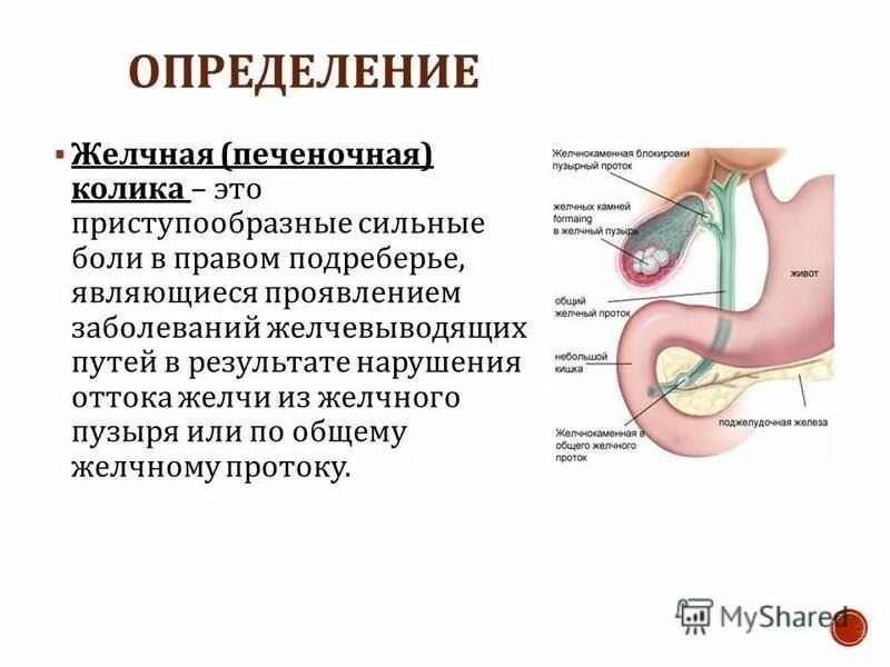 Боли в желудке и желчном. Желчная и печеночная колика. Локализация желчного пузыря. Печеночные колики печеночной.