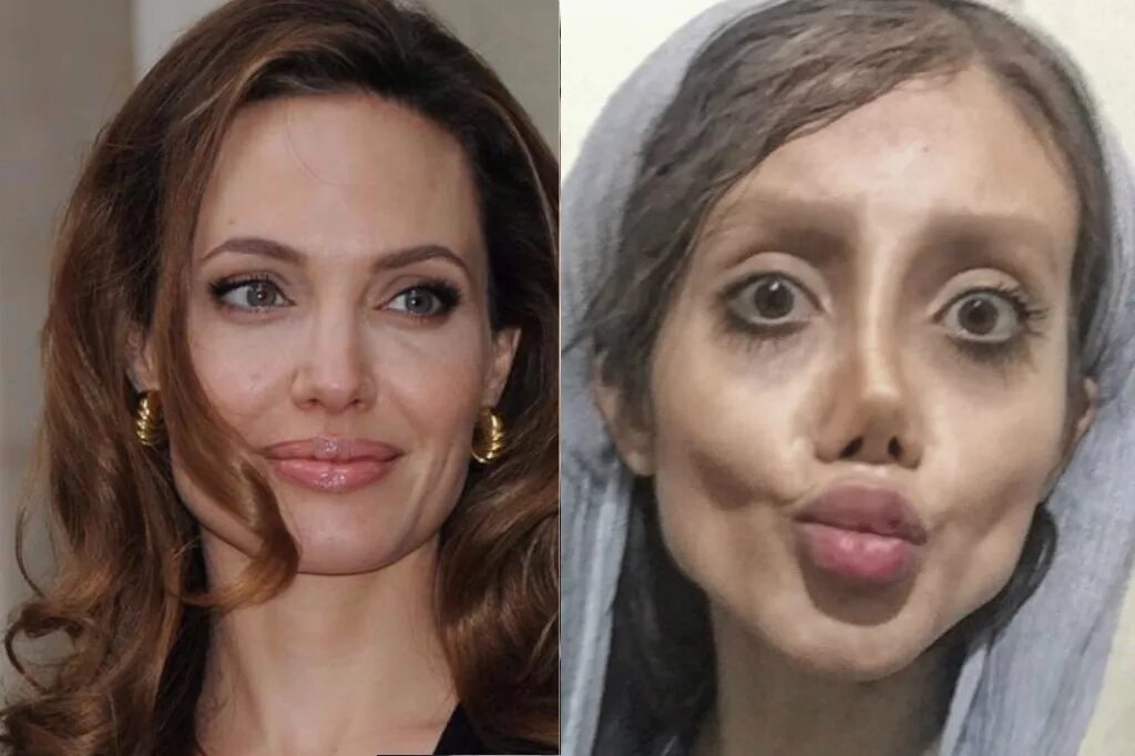 анджелина джоли сделала операцию. анджелина джоли пластические операции. сахар табар и анджелина джоли. сахар табар и анджелина джоли. анджелина джоли после операции.