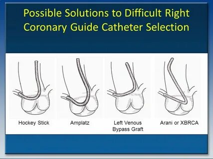 Possible solutions