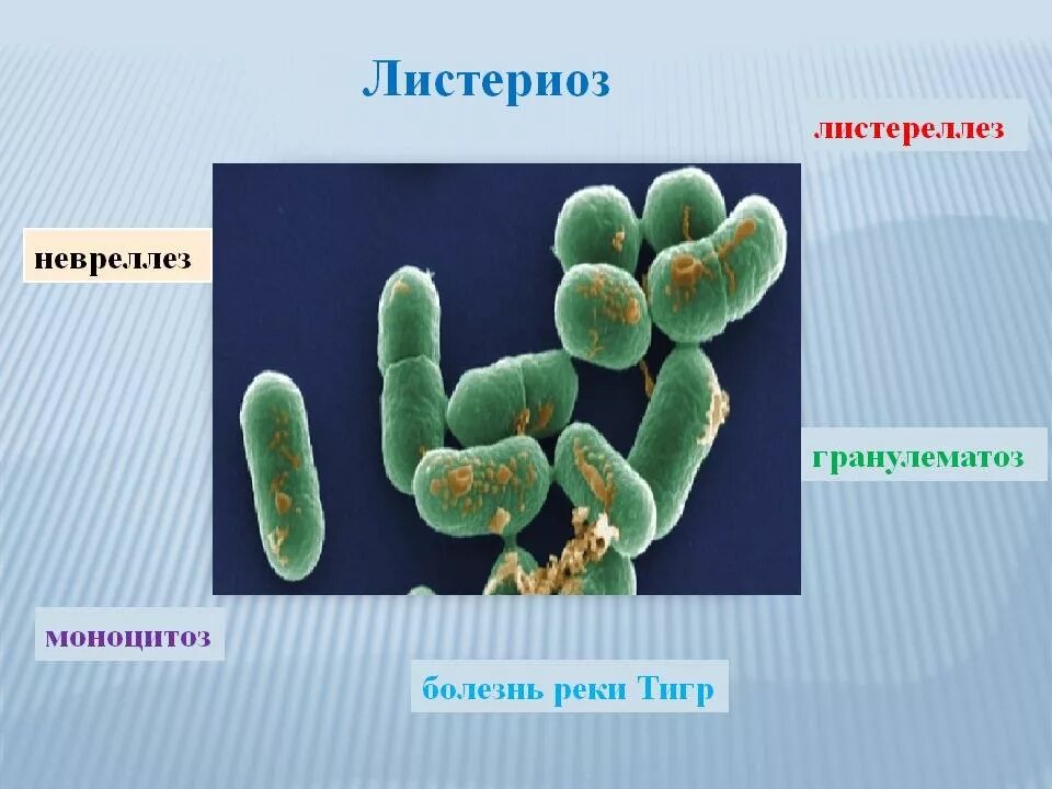 Листериоз лечение у человека. Листериоз инфекционные болезни. Листерия симптомы заражения. Листериоз ангинозная форма. Листериоз возбудитель заболевания.