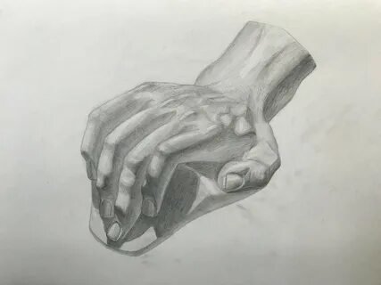 Гипсовая рука