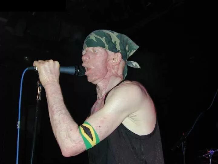 Yellowman регги. Винстон Фостер Yellowman. Yellowman