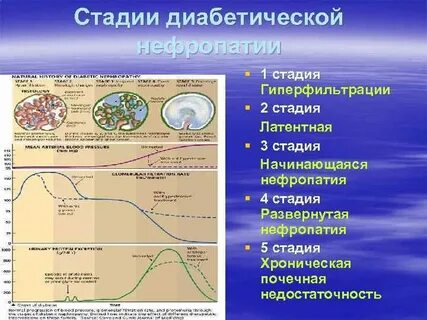 Стадии диабета