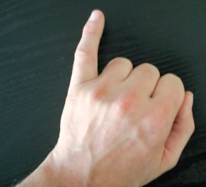 Что если взять человека за мизинец во сне. Мизинец во сне. Немеет большой и указательный палец на правой руке причины. Маленький большой палец. Анимение пальцев налево руке.
