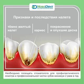 Сколько кариесов