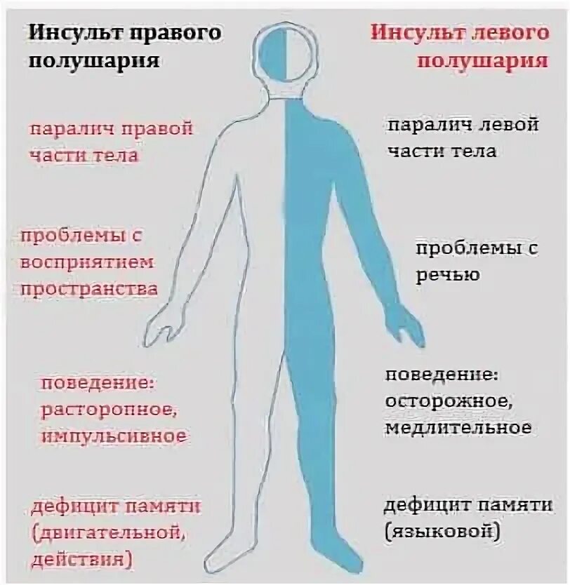 Парализовало левую сторону после инсульта. Ишемический инсульт неврологические симптомы. Клинические проявления инсульта. Ишемический инсульт человек. Клинические проявления ишемического инсульта.