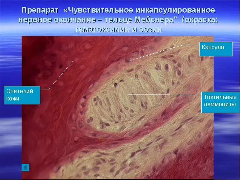 Тельца Мейснера гистология препарат. Клетки Мейснера гистология. Осязательные тельца Мейснера гистология. Осязательные тельца Мейснера в коже пальца. Тельца фатера