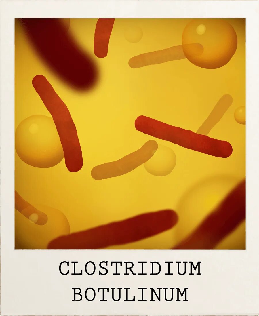 Clostridium spp. Клостридии ботулинум. Клостридия ботулинум морфология. Clostridium botulinum жгутики.