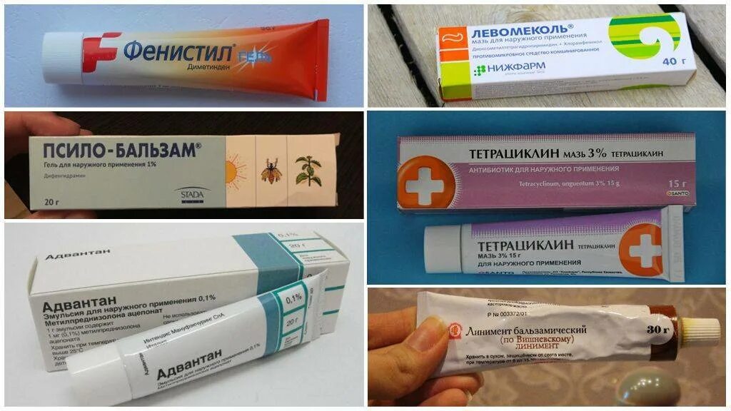 Аналоги фенистила геля от укусов насекомых. Мазь от укусов фенистил гель. заменитель фенистила геля для детей. фенистил мазь аналоги. диметинден фенистил гель.